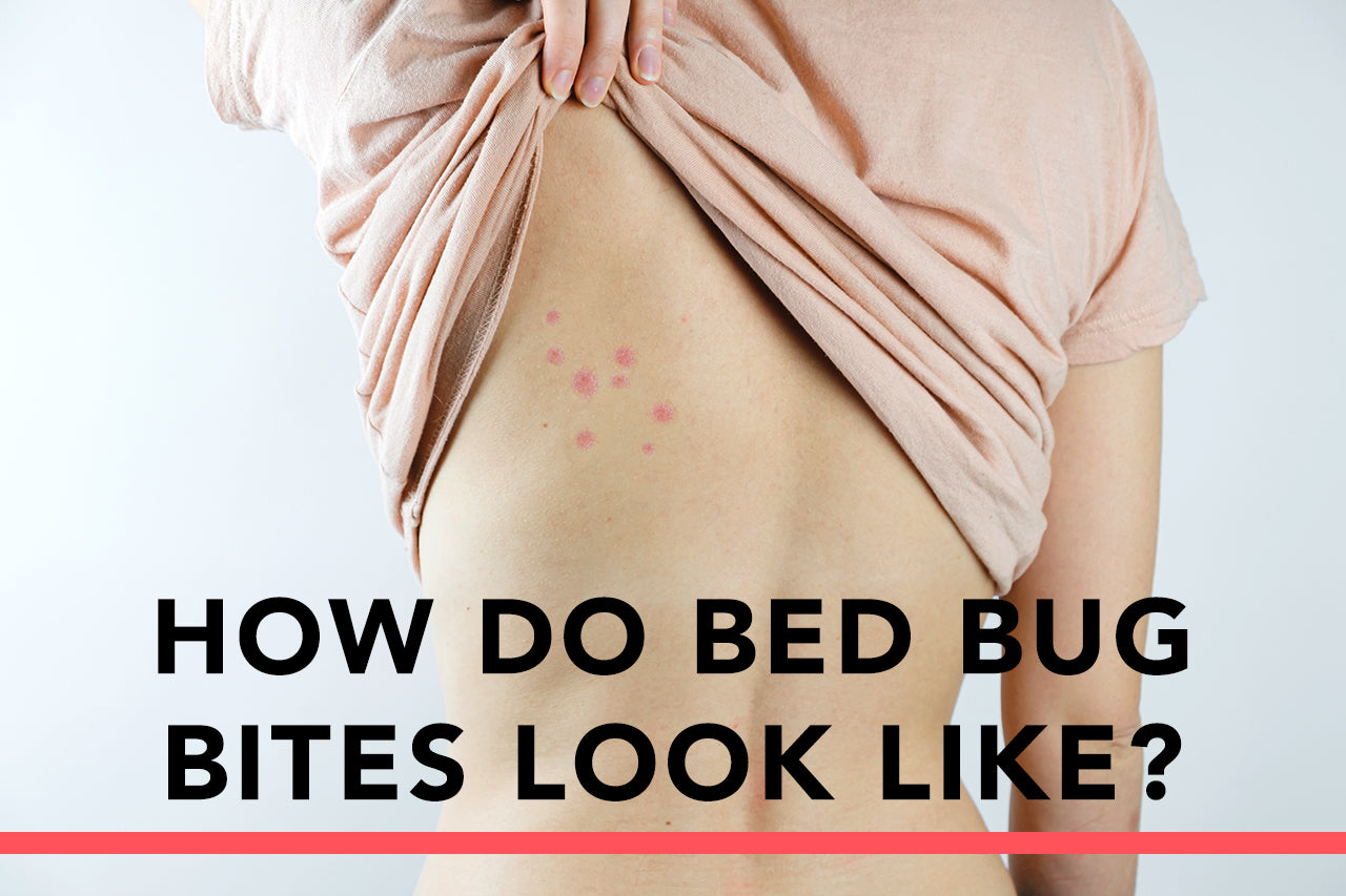 How Do Bed Bug Bites Look Like?