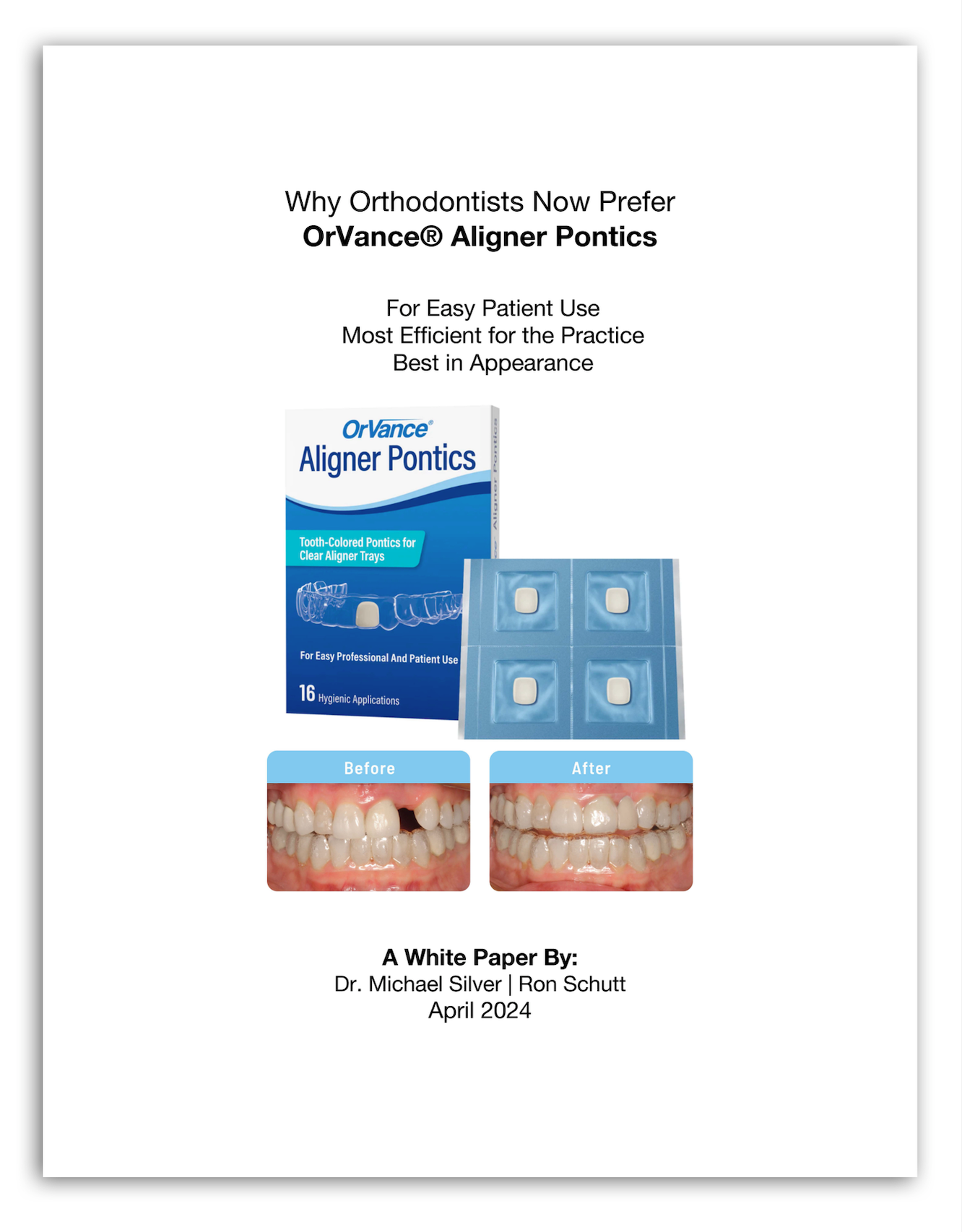 Why Orthodontists Now Prefer OrVance® Aligner Pontics