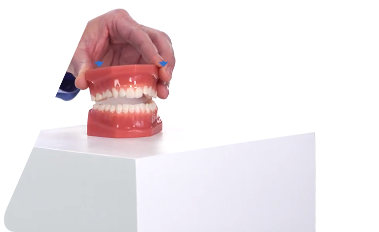 OrVance® Temporary Tooth Repair 