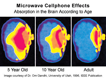 Microwave Cellphone Effects | EMF Brain Image | Einstein Brain