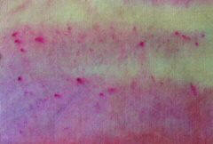 Speckles from undissolved dye