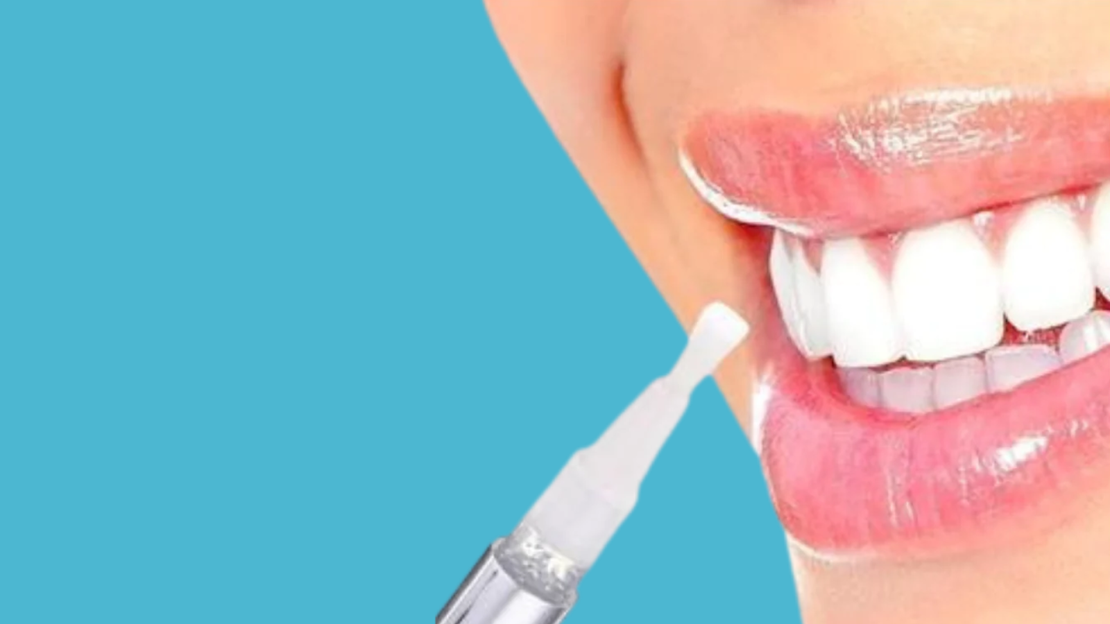 What to know about teeth whitening pens?