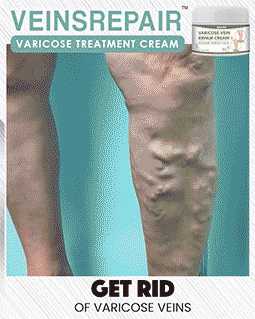 Varicose Treatment Cream
