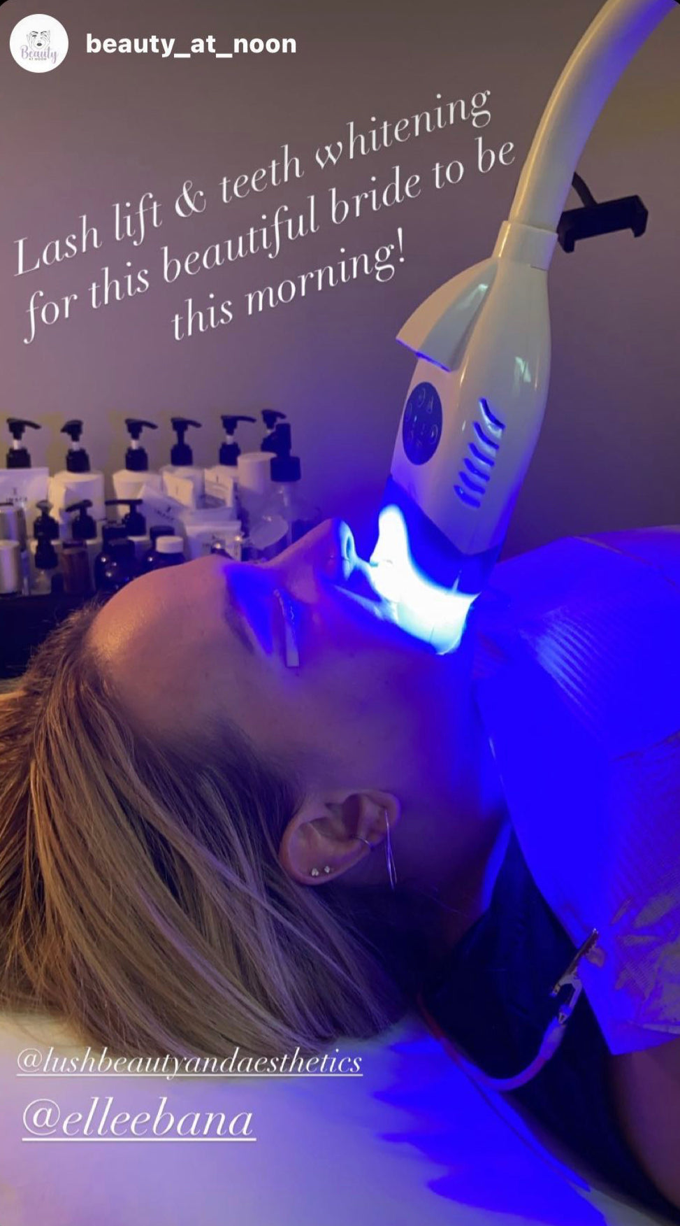 Professional Teeth Whitening Course + Kit Lush Beauty & Aesthetics