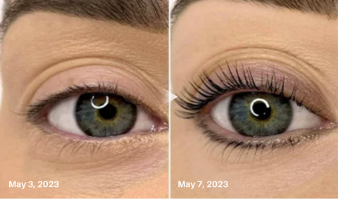Kerlash™ Advanced Eyelash Growth Serum
