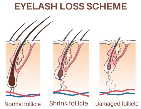Kerlash™ Advanced Eyelash Growth Serum