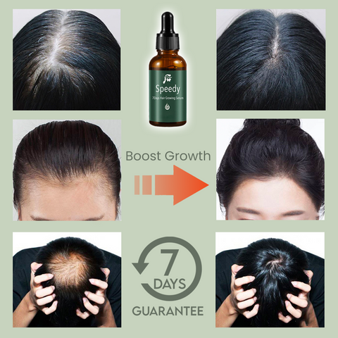 Speedy 7Days Hair Growing Serum
