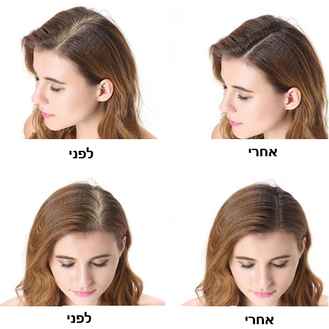 תרסיס לעצירת נשירת שיער