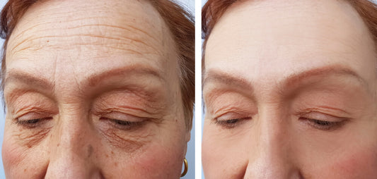 Fade Fine Lines and Wrinkles