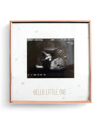 Baby Scan Photo Frame