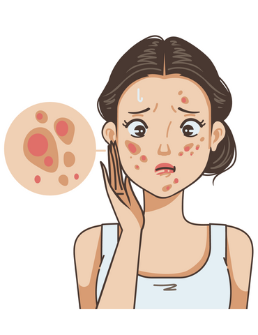 Learn about the causes and effective skincare practices to manage acne-prone skin