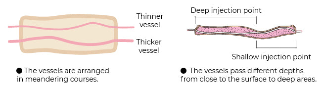 The vessels are arranged in