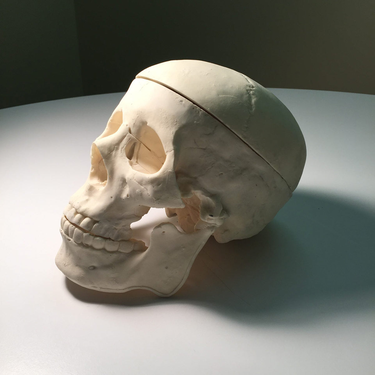 Adult Skull with Brain for X-Ray CT, US, MRI - True Phantom Solutions