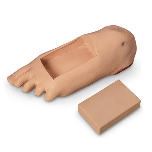 Edema Foot With Tissue Injury for GERi™-KERi™, Light Skin