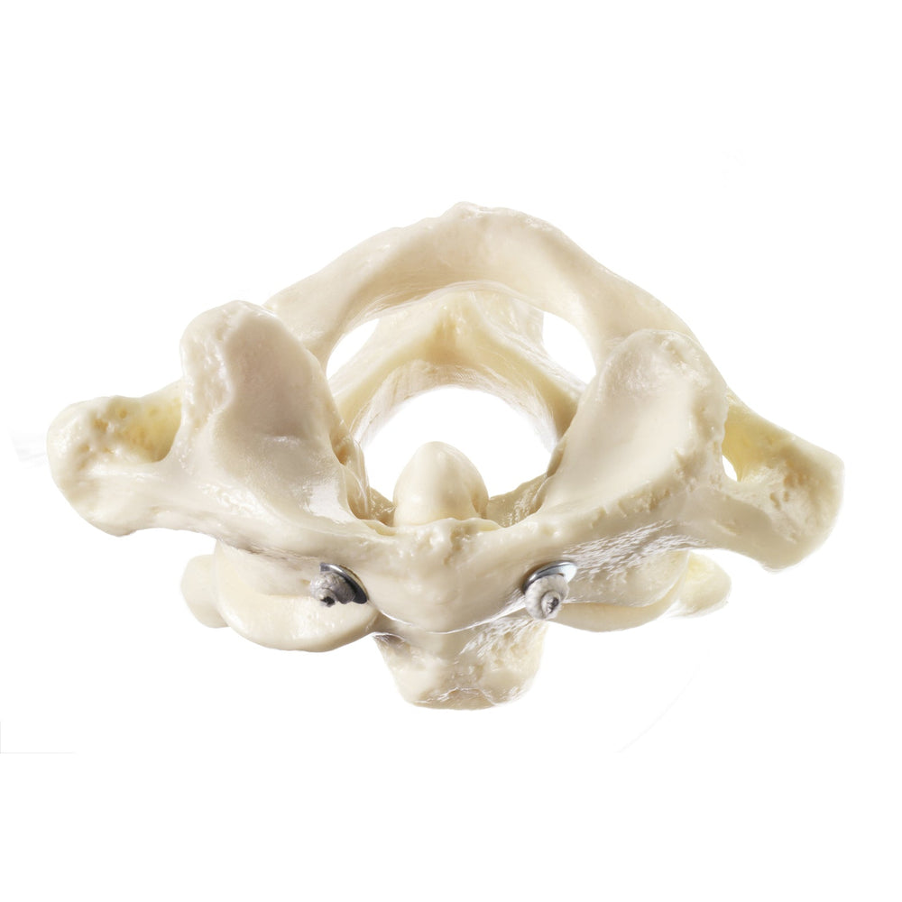 SOMSO First and Second Cervical Vertebrae (Atlas and axis ...