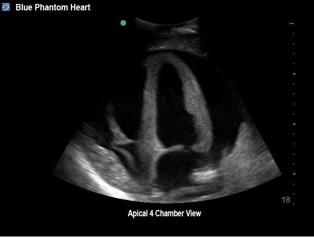 Transesophageal Echo And Transthoracic Echo Training Model Cae Blue