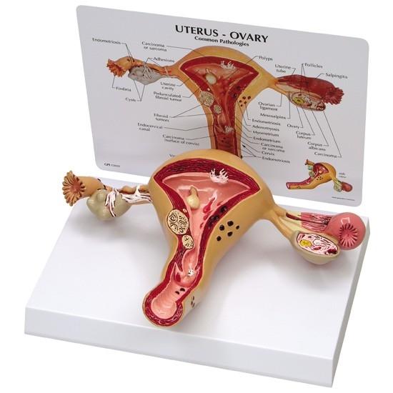 Breast Cross-Section Model, Replica Showing Common Pathologies for Human  Anatomy, Physiology Education, Anatomy Model for Doctor's Offices and
