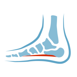 OrthoFlexx orthotics for plantar fasciitis