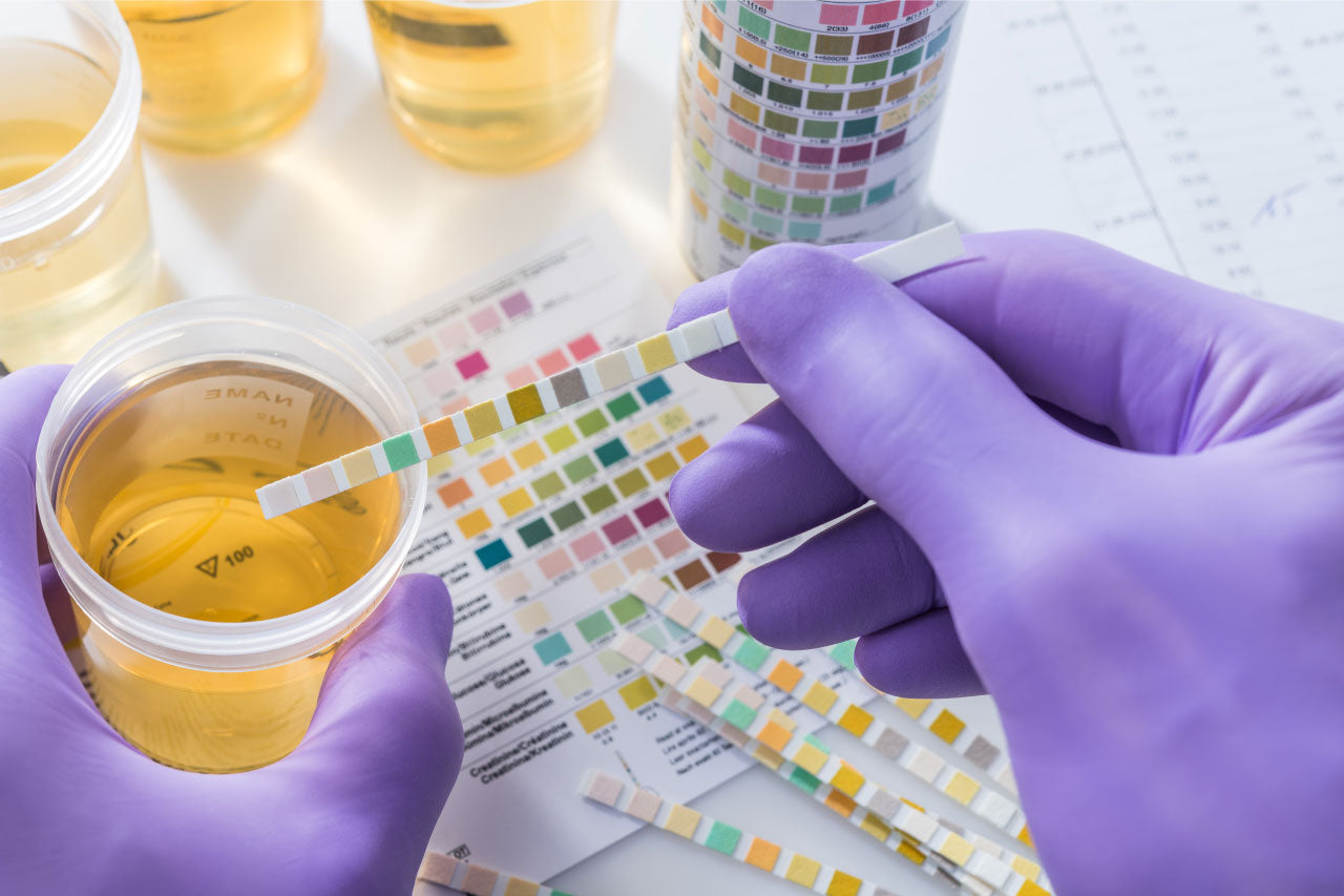 Image of a lab technician performing a urinalysis drug test.