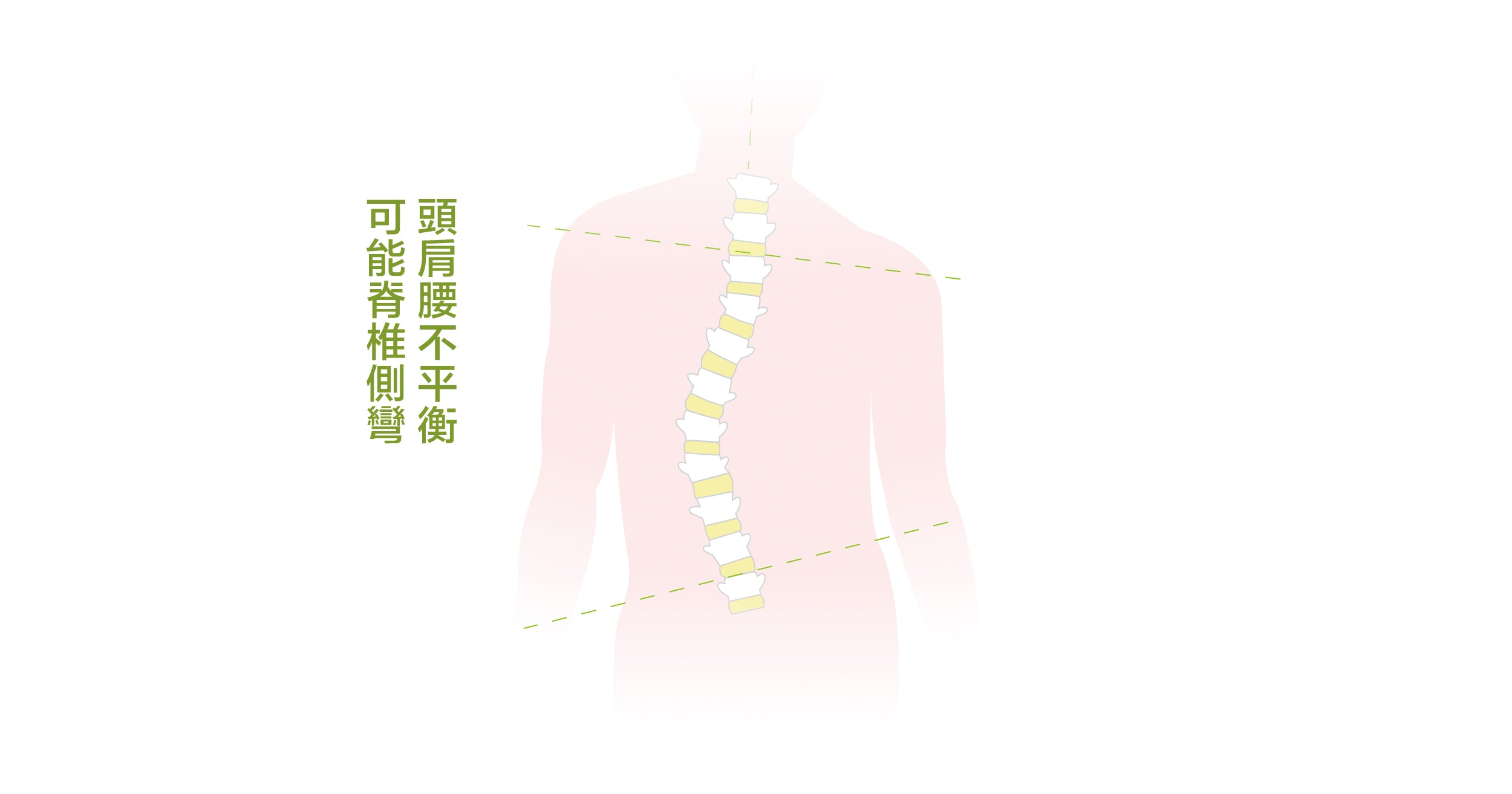 頭肩腰不平衡 可能脊椎側彎