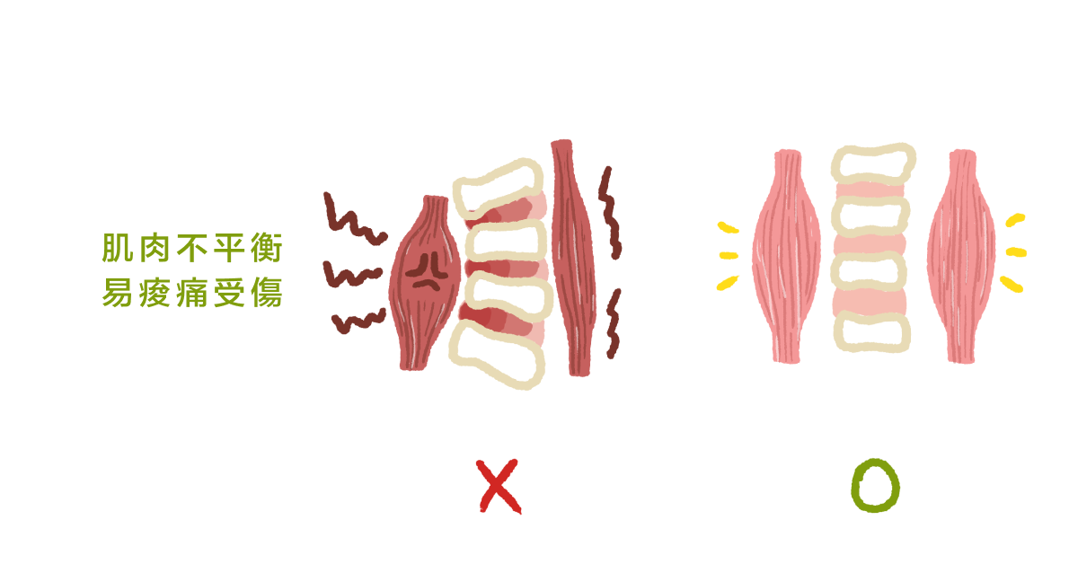 肌肉不平衡 易痠痛受傷