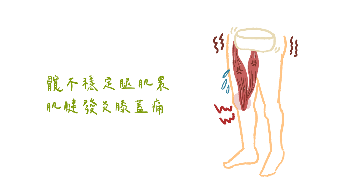 髖不穩定腿肌累 肌腱發炎膝蓋痛