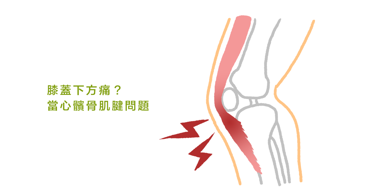 膝蓋下方痛？當心髕骨肌腱問題