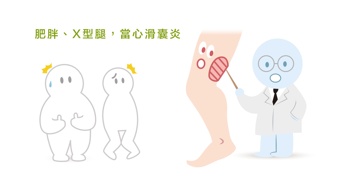 肥胖、Ｘ型腿，當心滑囊炎