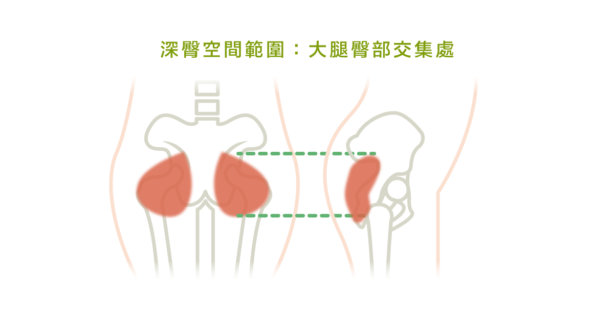 深臀空間範圍：大腿臀部交集處