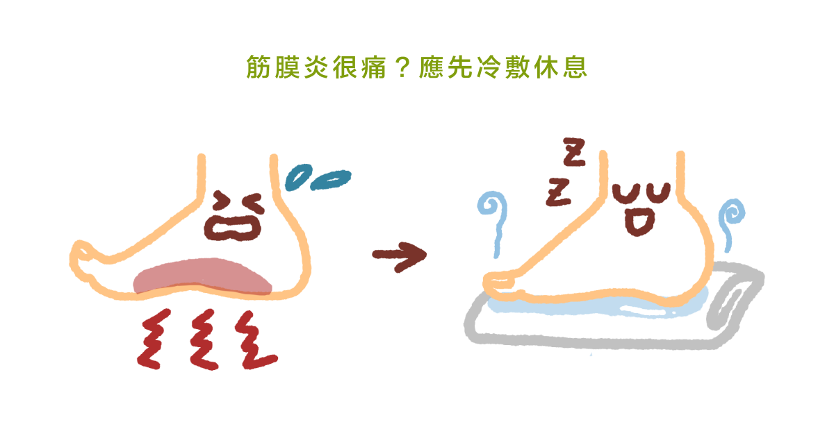 筋膜炎很痛？應先冷敷休息