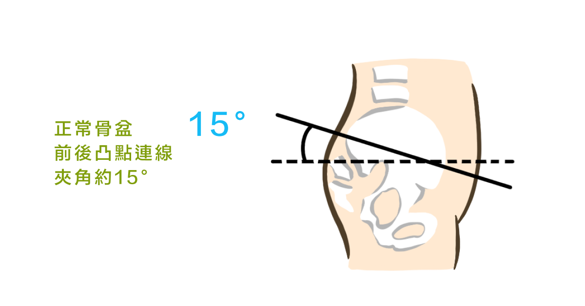 正常骨盆 前後凸點連線 夾角約15度