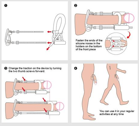 Male Penis extender