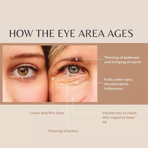 How the Eye Area Ages