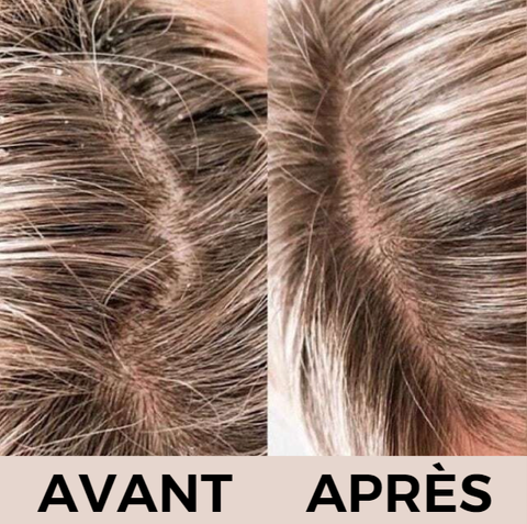 avantapres-detoxmyhair