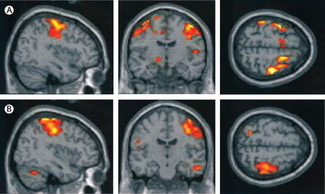 neurodevelopmental-toxicity-the-lancet