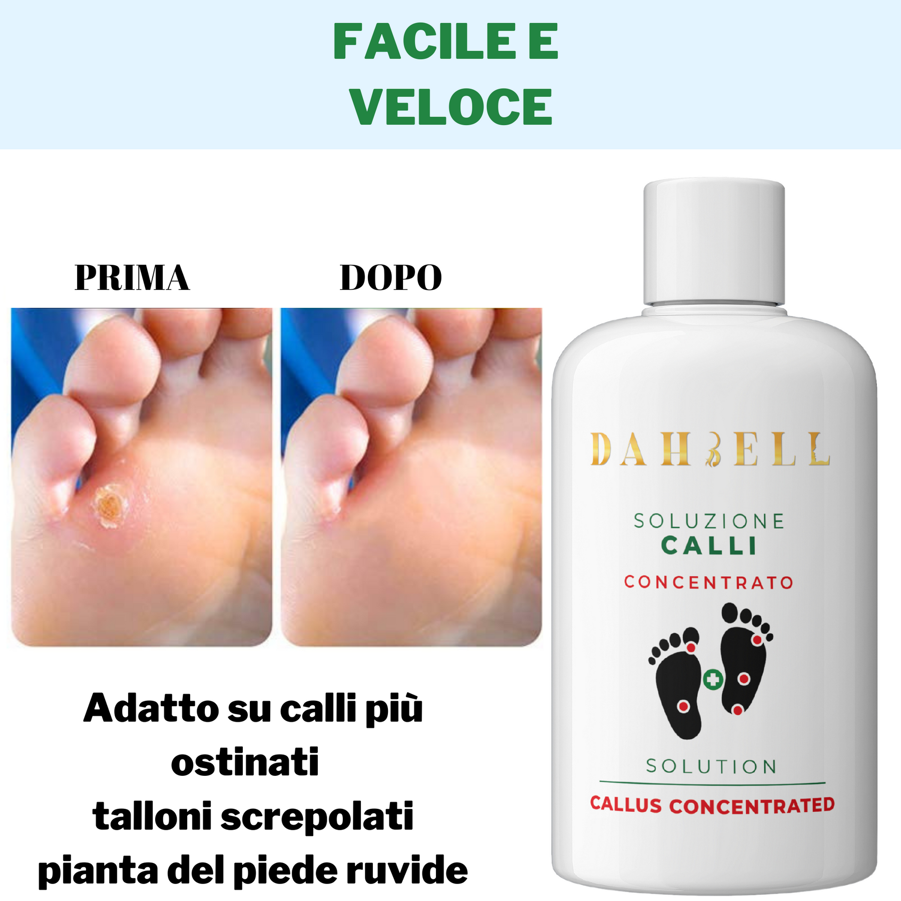 Crema per vene varicose – D A H B E L L