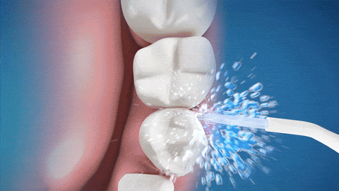 Resultado de imagem para irrigador dental gif
