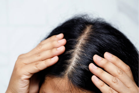 Haarverlust und Haarausfall