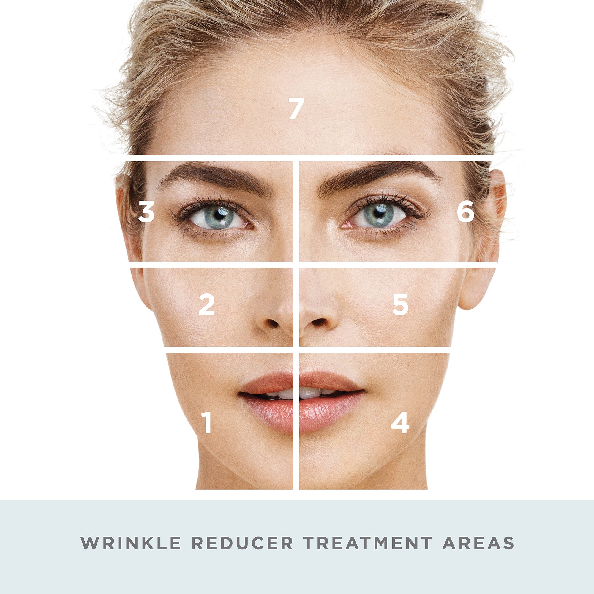 nuface wrinkle reducer attachment