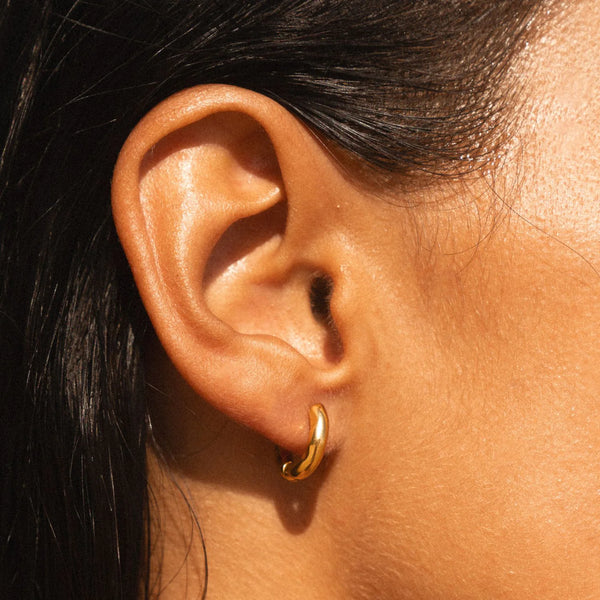 why do my ears itch when i wear earrings