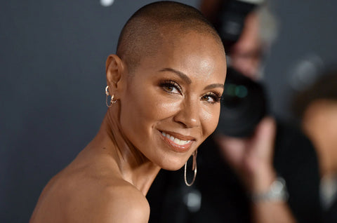 jada smith alopecia