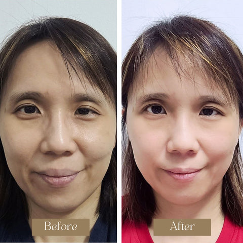 Before & After Results of the Lucent Brightening Multi-Active Balm