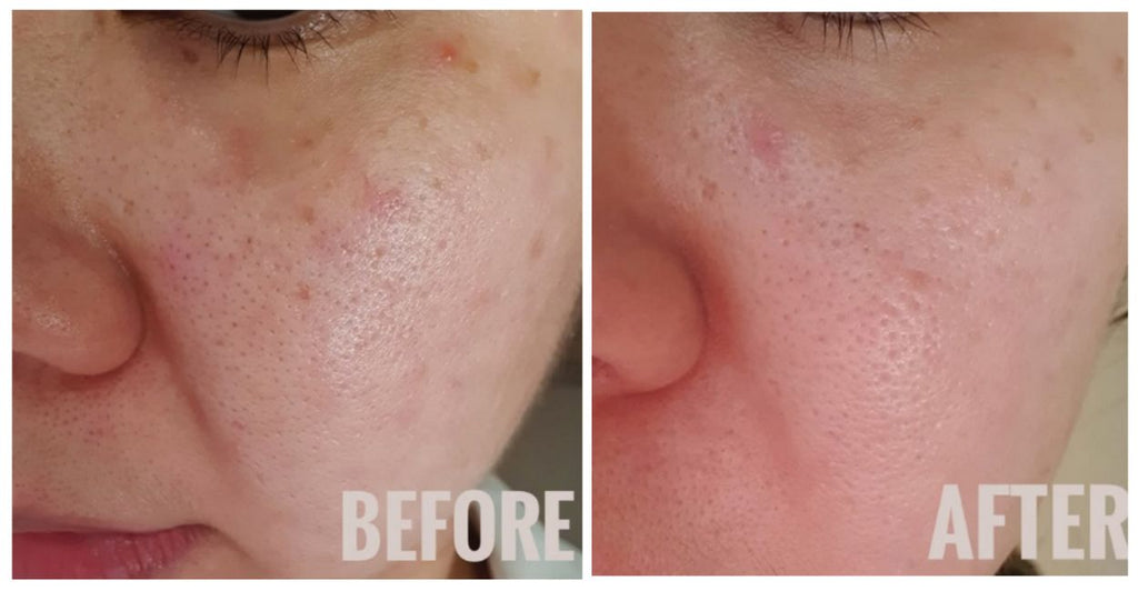 Before & After - MISEICO Miracle Pour Collagen Multi-Active Serum