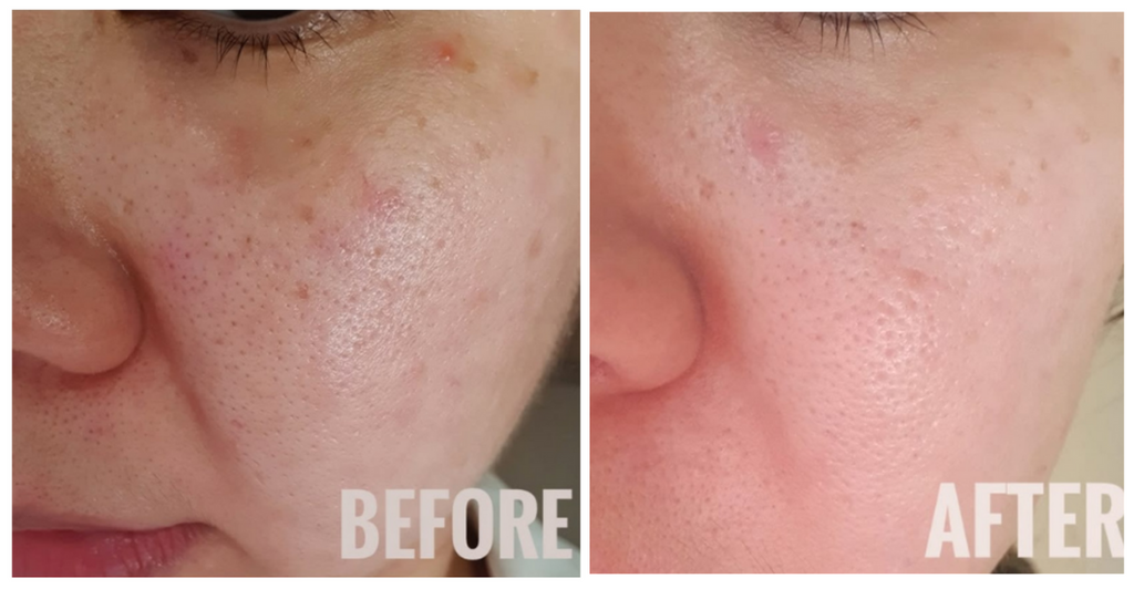 Miseico Miracle Pour Serum - Before & After Images