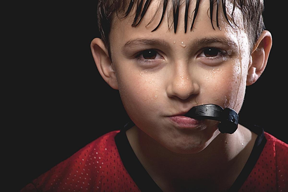 Mouthguards: Essential Protection for Active Smiles, mouth guard
