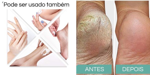 Creme Hidratante de Absorção Rápida para Pés