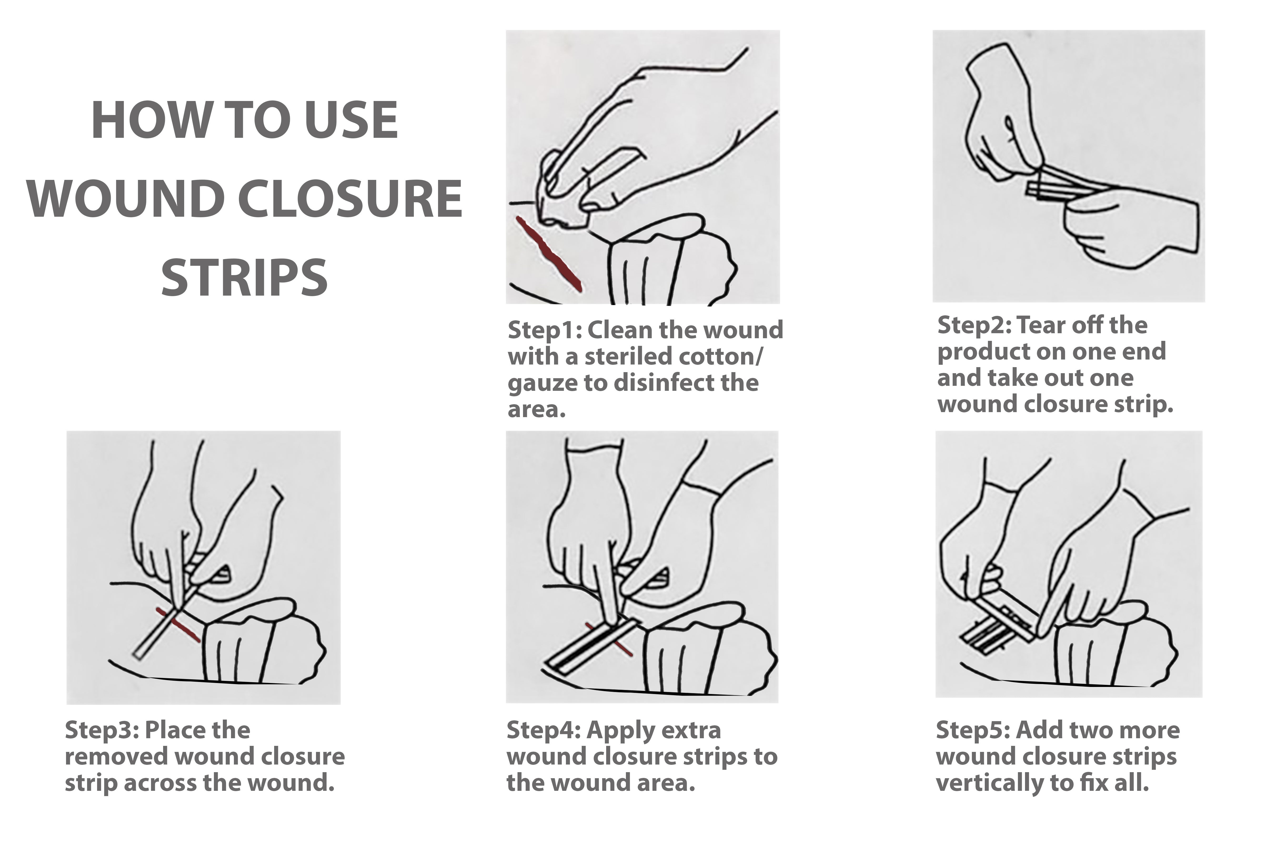 Endure Wound Skin Closures, Reinforced