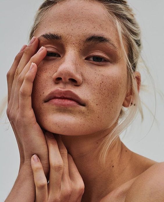 blonde girl with freckles