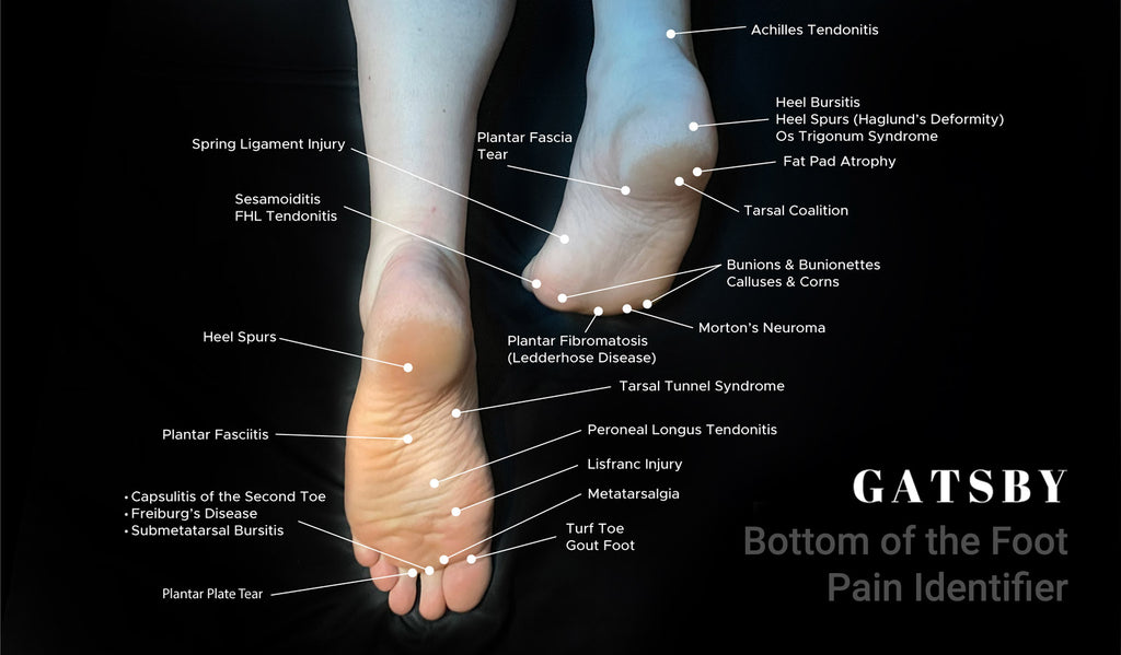 21+ Top Foot Pain Diagnosis Chart - LaurenceMahak