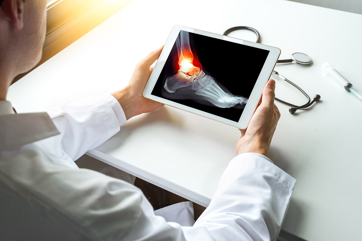 doctor examining an x ray of a foot injury